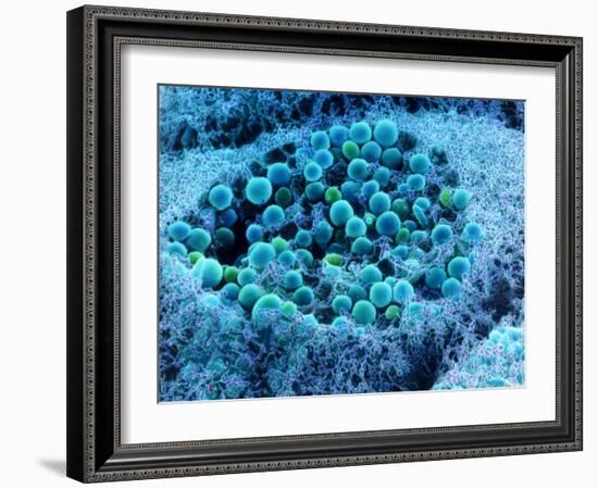 Col. SEM of Eye Melanocyte Cell & Pigment Granules-Steve Gschmeissner-Framed Photographic Print