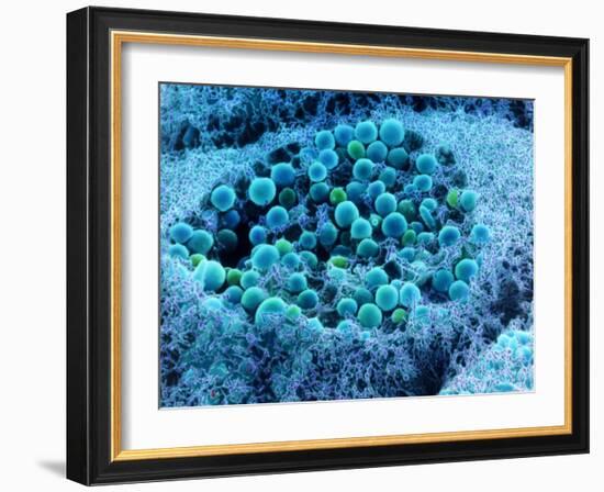 Col. SEM of Eye Melanocyte Cell & Pigment Granules-Steve Gschmeissner-Framed Photographic Print