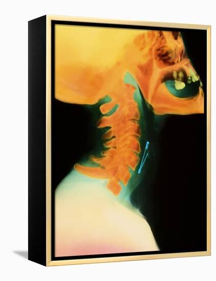 Col X-ray of Object Safety Pin Lodged In-Science Photo Library-Framed Premier Image Canvas