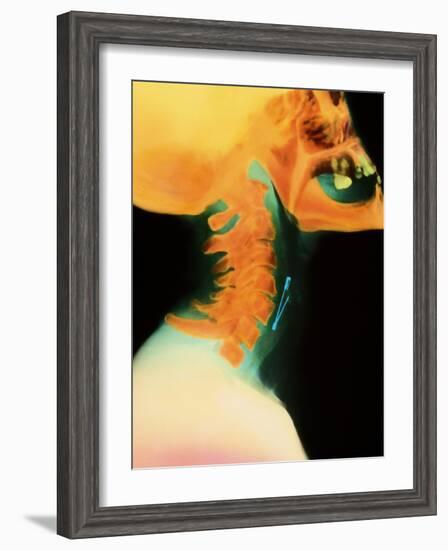 Col X-ray of Object Safety Pin Lodged In-Science Photo Library-Framed Photographic Print