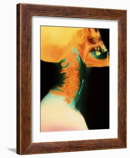 Col X-ray of Object Safety Pin Lodged In-Science Photo Library-Framed Photographic Print