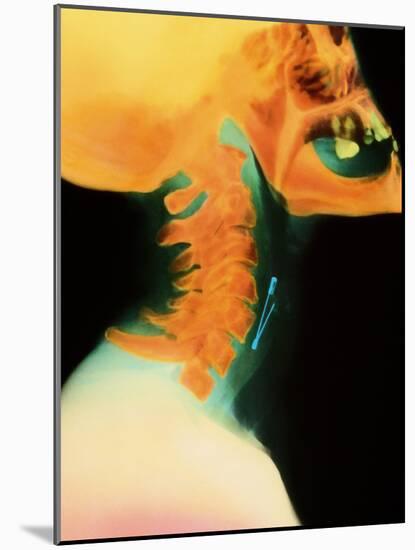 Col X-ray of Object Safety Pin Lodged In-Science Photo Library-Mounted Photographic Print