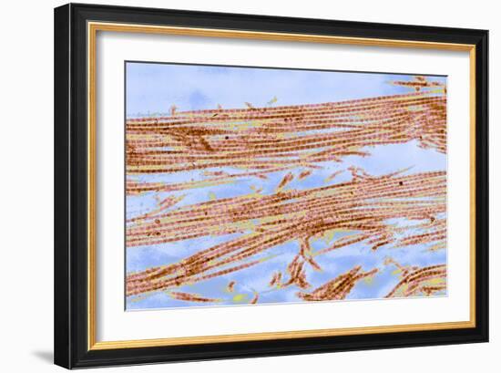 Collagen Fibres, TEM-Thomas Deerinck-Framed Photographic Print