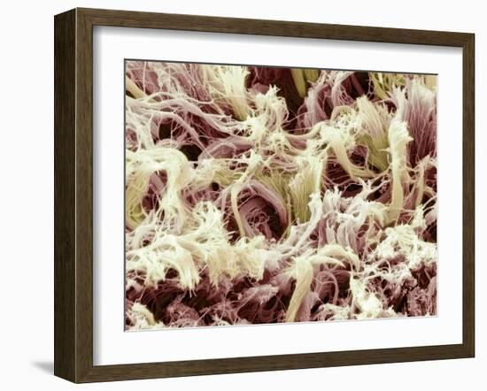 Collagen, SEM-Steve Gschmeissner-Framed Photographic Print