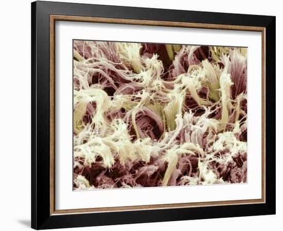 Collagen, SEM-Steve Gschmeissner-Framed Photographic Print