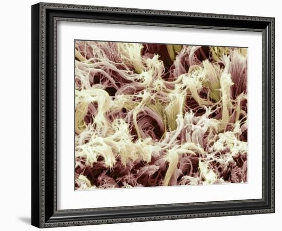 Collagen, SEM-Steve Gschmeissner-Framed Photographic Print