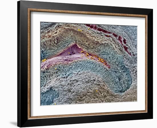 Collapsed Ovarian Follicle, SEM-Steve Gschmeissner-Framed Photographic Print