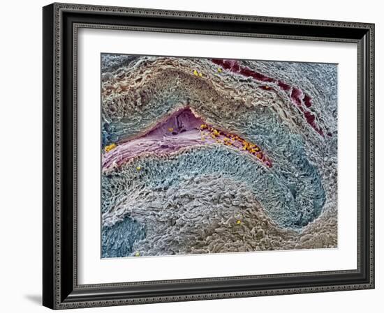 Collapsed Ovarian Follicle, SEM-Steve Gschmeissner-Framed Photographic Print