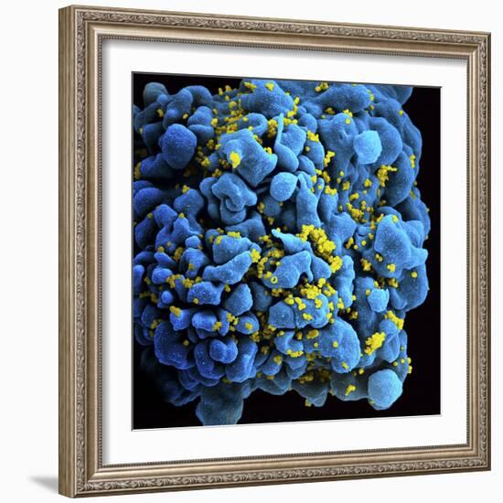 Colorized Image of Hiv-Infected H9 T-Cell-Stocktrek Images-Framed Photographic Print