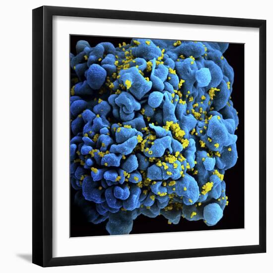 Colorized Image of Hiv-Infected H9 T-Cell-Stocktrek Images-Framed Photographic Print