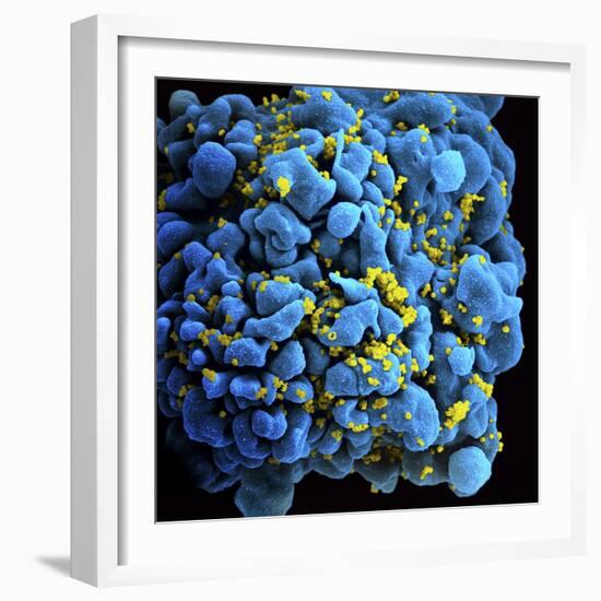 Colorized Image of Hiv-Infected H9 T-Cell-Stocktrek Images-Framed Photographic Print