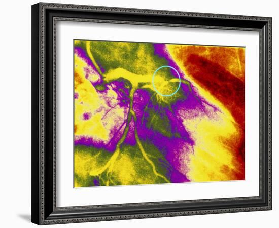Colour Angiogram of Left Coronary Artery Stenosis-Mehau Kulyk-Framed Photographic Print