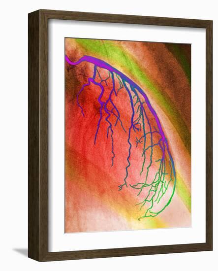 Coloured Angiogram of Coronary Artery of the Heart-Science Photo Library-Framed Photographic Print