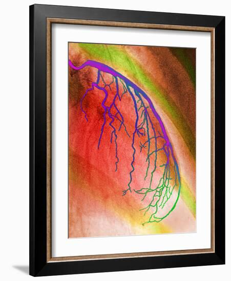 Coloured Angiogram of Coronary Artery of the Heart-Science Photo Library-Framed Photographic Print