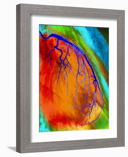 Coloured Angiogram of Coronary Artery of the Heart-Science Photo Library-Framed Photographic Print
