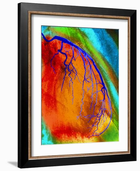 Coloured Angiogram of Coronary Artery of the Heart-Science Photo Library-Framed Photographic Print