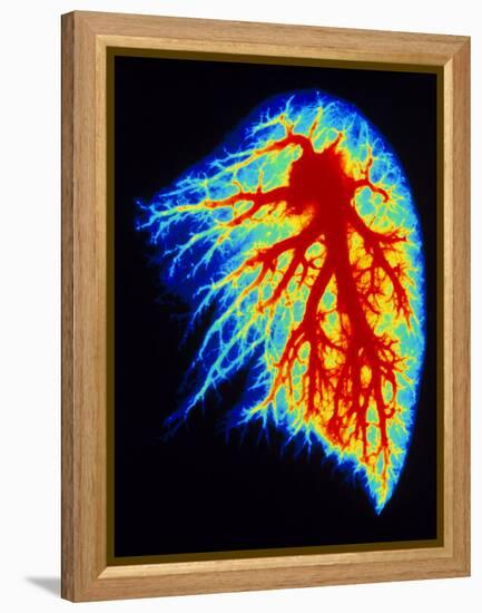 Coloured Angiogram of Pulmonary Arteries of Lung-Science Photo Library-Framed Premier Image Canvas