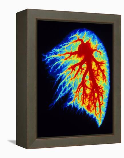 Coloured Angiogram of Pulmonary Arteries of Lung-Science Photo Library-Framed Premier Image Canvas