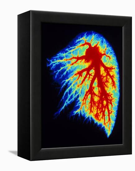 Coloured Angiogram of Pulmonary Arteries of Lung-Science Photo Library-Framed Premier Image Canvas