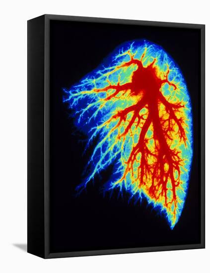 Coloured Angiogram of Pulmonary Arteries of Lung-Science Photo Library-Framed Premier Image Canvas