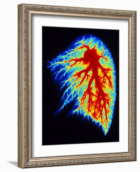 Coloured Angiogram of Pulmonary Arteries of Lung-Science Photo Library-Framed Photographic Print