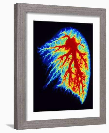 Coloured Angiogram of Pulmonary Arteries of Lung-Science Photo Library-Framed Photographic Print