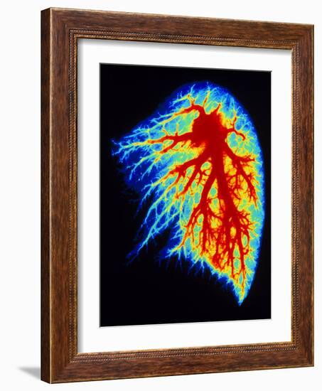 Coloured Angiogram of Pulmonary Arteries of Lung-Science Photo Library-Framed Photographic Print