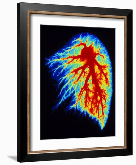 Coloured Angiogram of Pulmonary Arteries of Lung-Science Photo Library-Framed Photographic Print