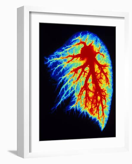 Coloured Angiogram of Pulmonary Arteries of Lung-Science Photo Library-Framed Photographic Print