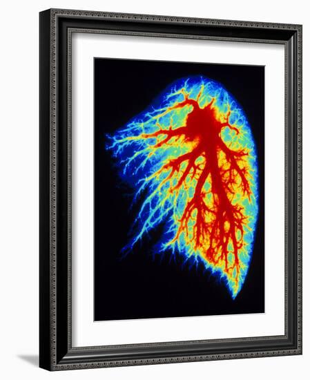 Coloured Angiogram of Pulmonary Arteries of Lung-Science Photo Library-Framed Photographic Print