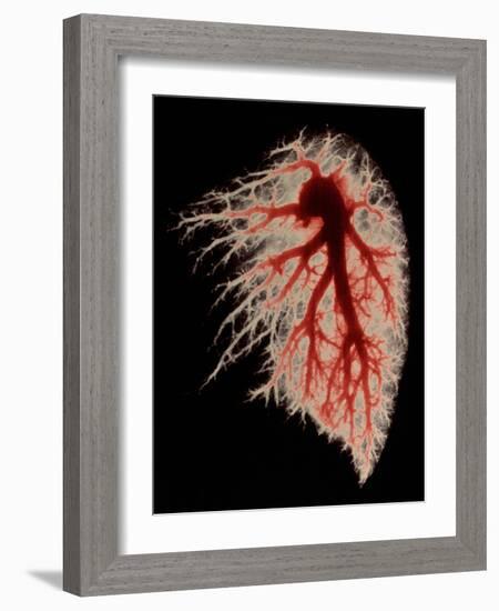 Coloured Angiogram of Pulmonary Arteries of Lung-Science Photo Library-Framed Photographic Print