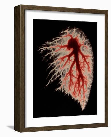 Coloured Angiogram of Pulmonary Arteries of Lung-Science Photo Library-Framed Photographic Print