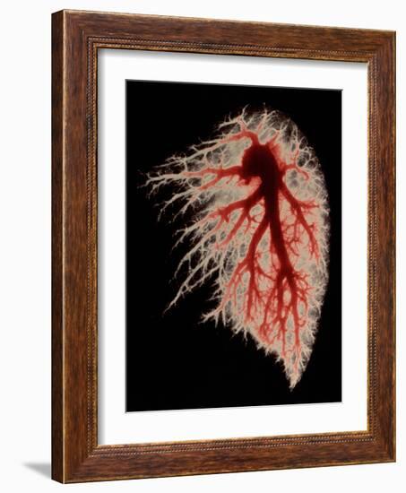 Coloured Angiogram of Pulmonary Arteries of Lung-Science Photo Library-Framed Photographic Print
