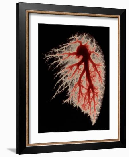 Coloured Angiogram of Pulmonary Arteries of Lung-Science Photo Library-Framed Photographic Print