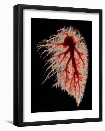 Coloured Angiogram of Pulmonary Arteries of Lung-Science Photo Library-Framed Photographic Print