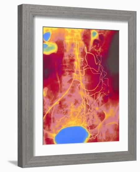 Coloured Angiogram (X-ray) of Mesenteric Arteries-Mehau Kulyk-Framed Photographic Print