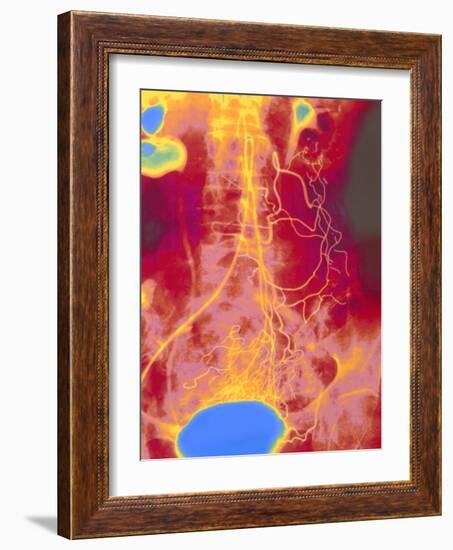 Coloured Angiogram (X-ray) of Mesenteric Arteries-Mehau Kulyk-Framed Photographic Print