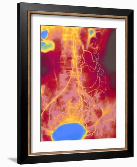 Coloured Angiogram (X-ray) of Mesenteric Arteries-Mehau Kulyk-Framed Photographic Print