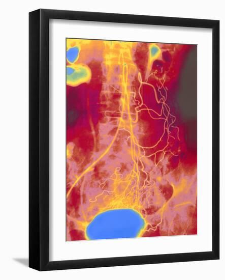 Coloured Angiogram (X-ray) of Mesenteric Arteries-Mehau Kulyk-Framed Photographic Print