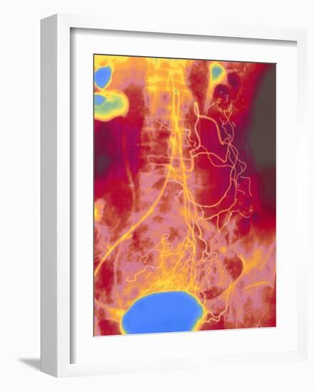 Coloured Angiogram (X-ray) of Mesenteric Arteries-Mehau Kulyk-Framed Photographic Print