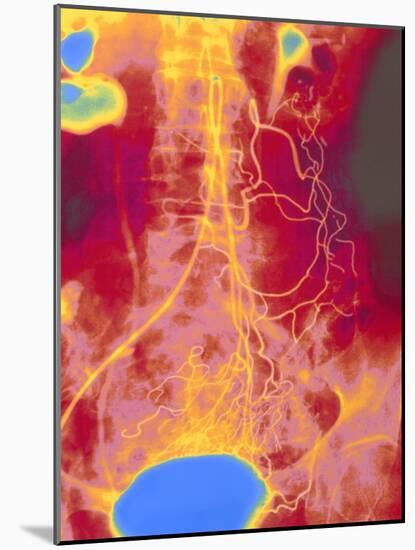 Coloured Angiogram (X-ray) of Mesenteric Arteries-Mehau Kulyk-Mounted Photographic Print