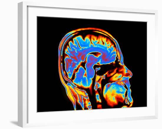 Coloured CT Scan of the Brain In Head (side View)-PASIEKA-Framed Photographic Print