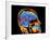 Coloured CT Scan of the Brain In Head (side View)-PASIEKA-Framed Photographic Print