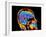 Coloured CT Scan of the Brain In Head (side View)-PASIEKA-Framed Photographic Print