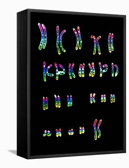 Coloured LM of a Normal Female Karyotype-L. Willatt-Framed Premier Image Canvas