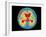 Coloured MRI Brain Scan of Abscess In Meningitis-Mehau Kulyk-Framed Photographic Print