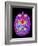Coloured MRI Brain Scan: Pituitary Adenoma-Mehau Kulyk-Framed Photographic Print