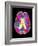 Coloured MRI Scan of Organophosphate Brain Damage-Mehau Kulyk-Framed Photographic Print