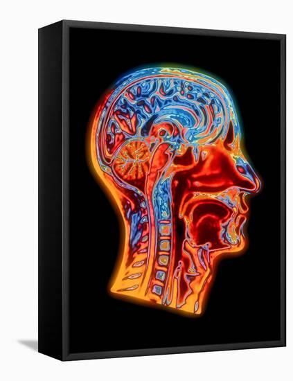 Coloured MRI Scan of the Human Head (side View)-PASIEKA-Framed Premier Image Canvas