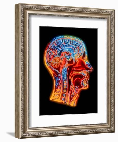 Coloured MRI Scan of the Human Head (side View)-PASIEKA-Framed Premium Photographic Print